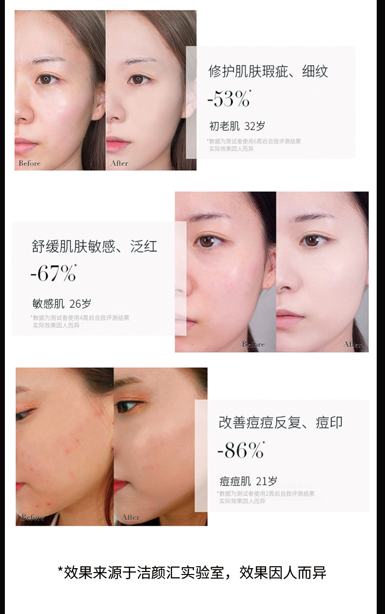 Serum Vitamine E ROUSHUN Thần Dược Của Da Tác Dụng Dưỡng ẩm Chống Lão Hóa Xóa Mờ Nám Tàn Nhang Giúp Da Trẻ Đẹp Trắng Sáng