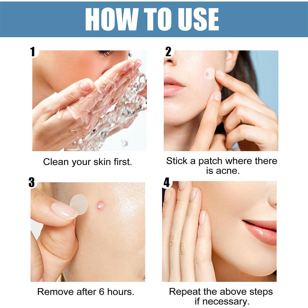 Yuanyan%2080pcs/set%20Large%20Size%20Acne%20Pimple%20Patch%20Face%20Treatment%20Invisible%20Tools%20Acne%20Remover%20Blemish%20Pimples%20Stickers%20D3T7%20-%20Image%205