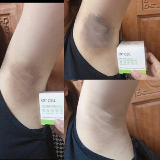 Kem trị thâm nách, thâm môi, thâm nhũ hoa hàn quốc - ol+cell