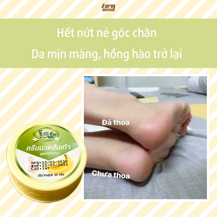 Kem dưỡng da nứt gót chân chuối thái lan 30ml