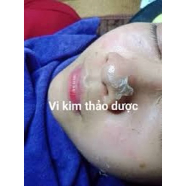 Siêu Vi Kim Thảo dượᴄ . Vi Kim Thảo Mộc ( Siêu Vi Kim )