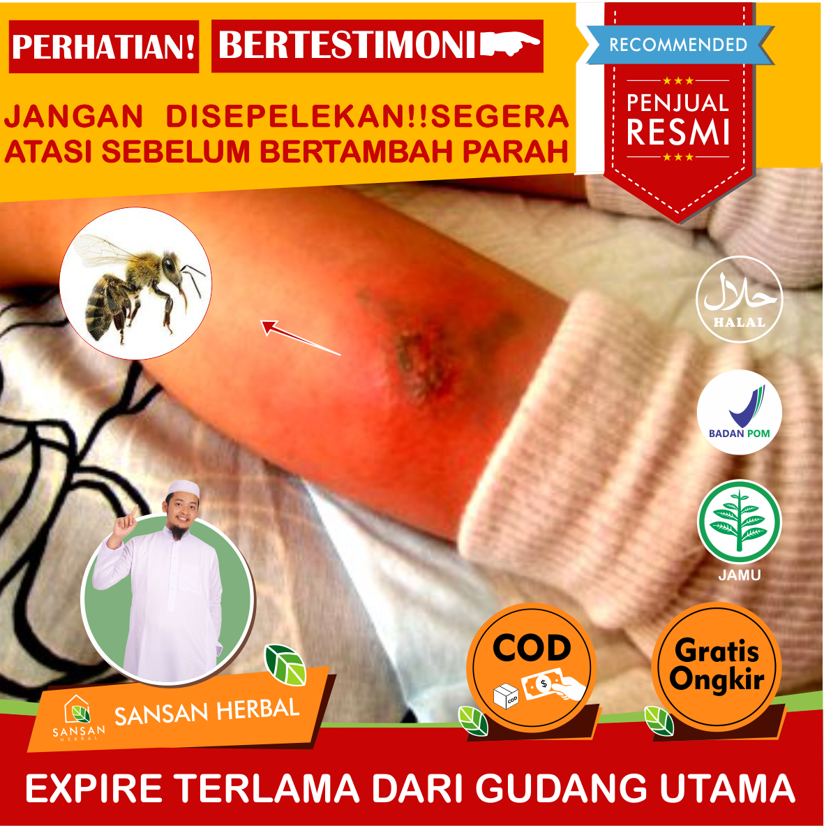 Obat Gigitan Serangga Pada Bayi, Salep Gatal Gigitan Serangga, Obat