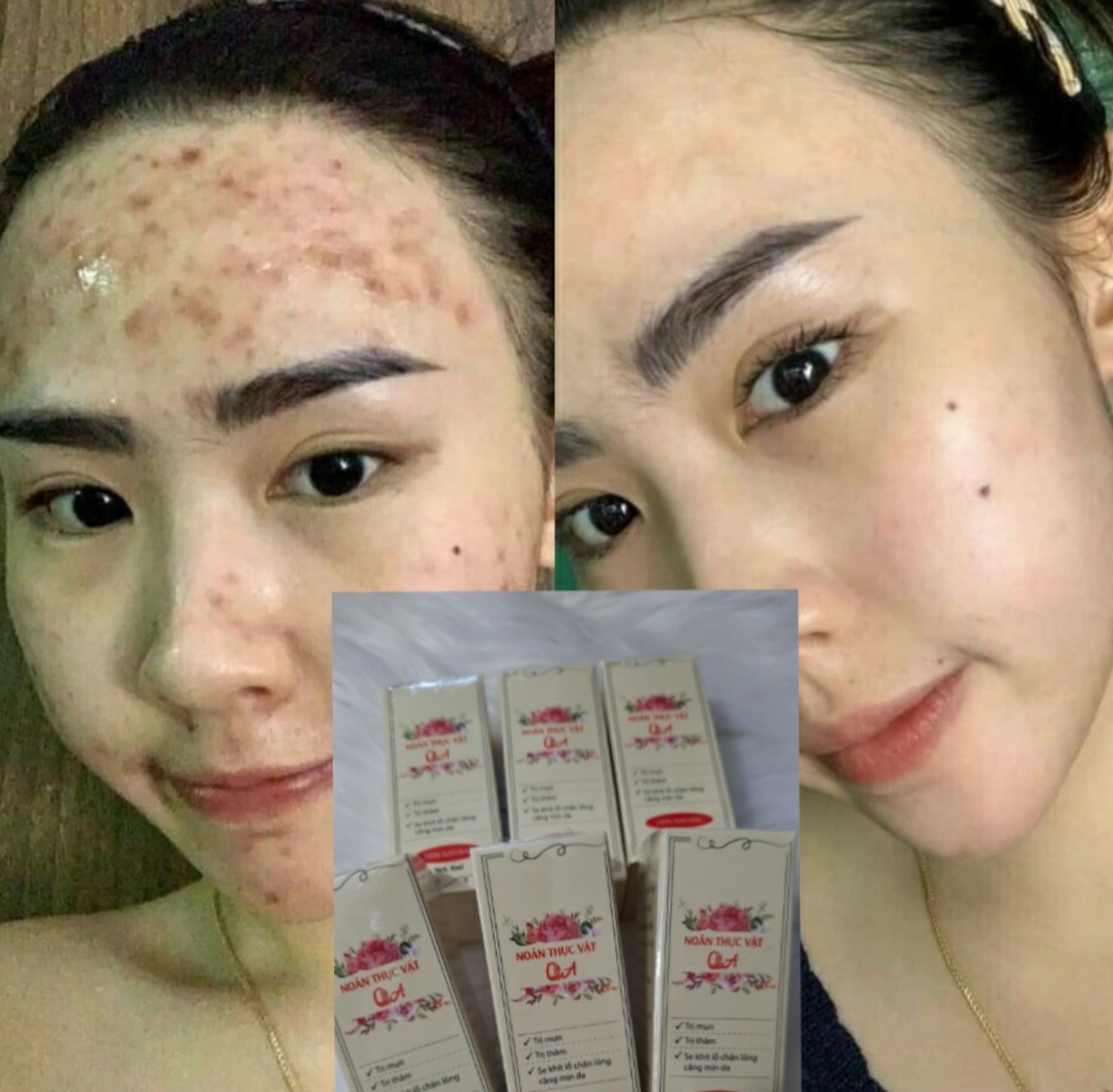 Noãn thực vật QA beauty spa