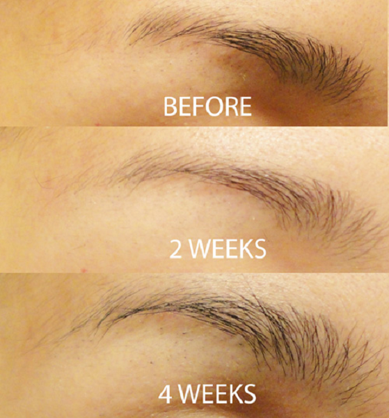 Serum dưỡng lông mày Revitabrow Advanced Eyebrow Conditioner 0.9ml