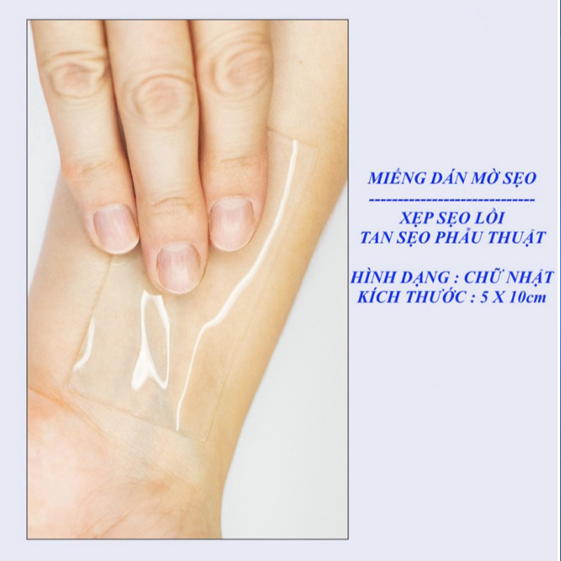 Miếng dán ép phẳng cải thiện sẹo lồi, phì đại Rejuvaskin Scar FX