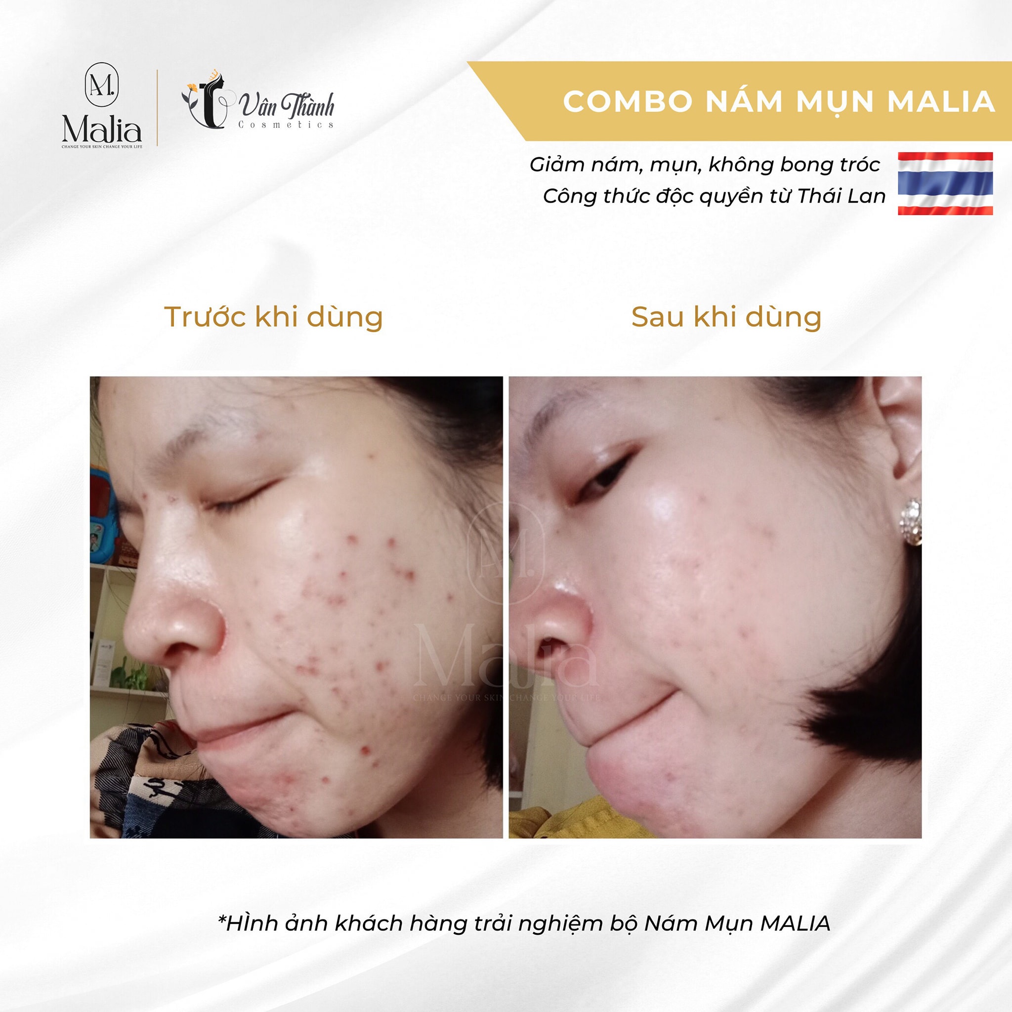 Combo Bộ Dưỡng da cao cấp Thái Lan Malia (Mini size) - Mẫu mới 2022