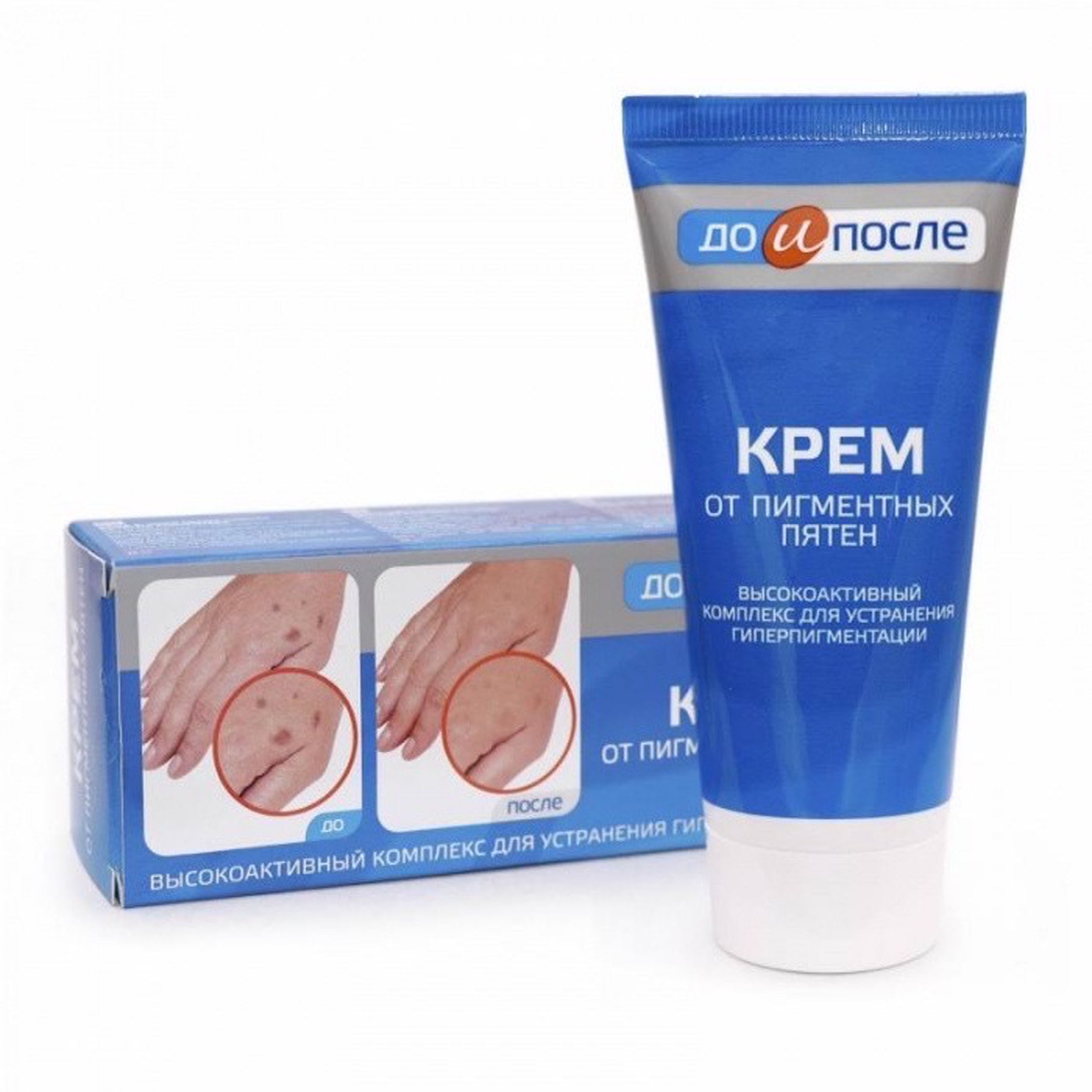 [HCM]Kem bôi mờ đồi mồi Nga Kpem