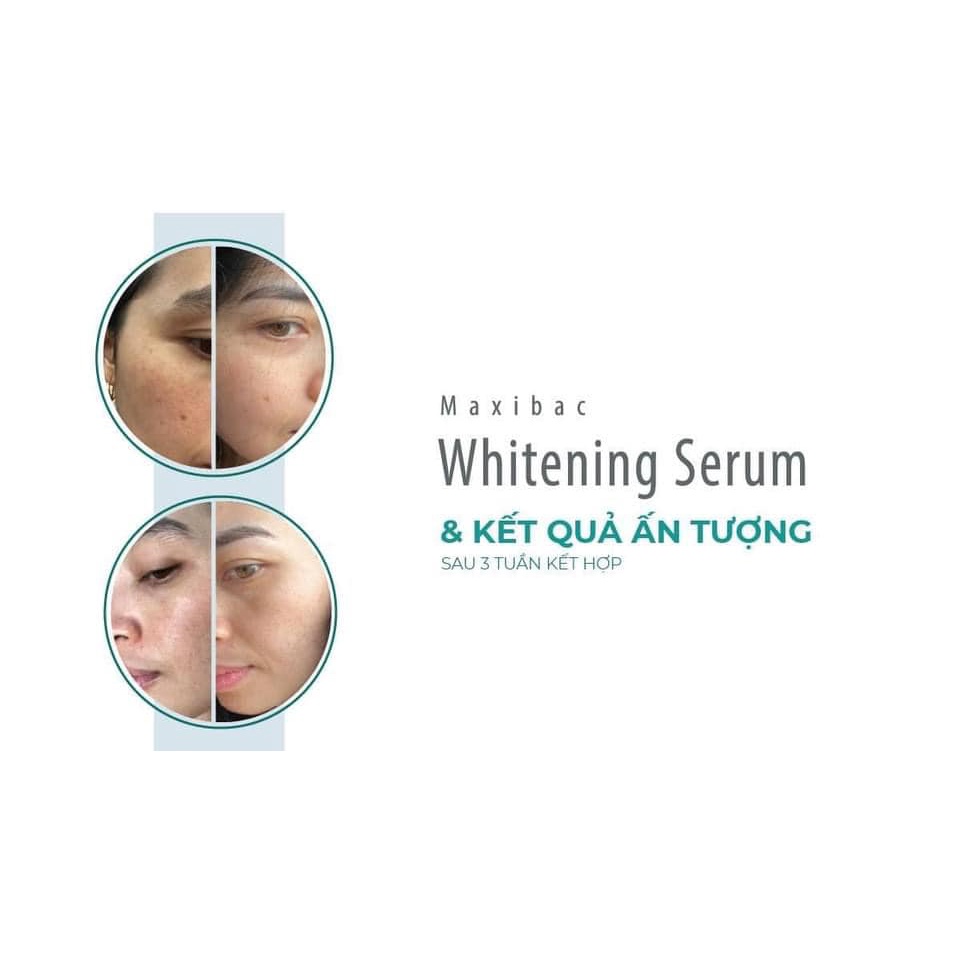 Maxibac Whitening Serum - Serum mờ ƞám dưỡng trắng da Maxibac