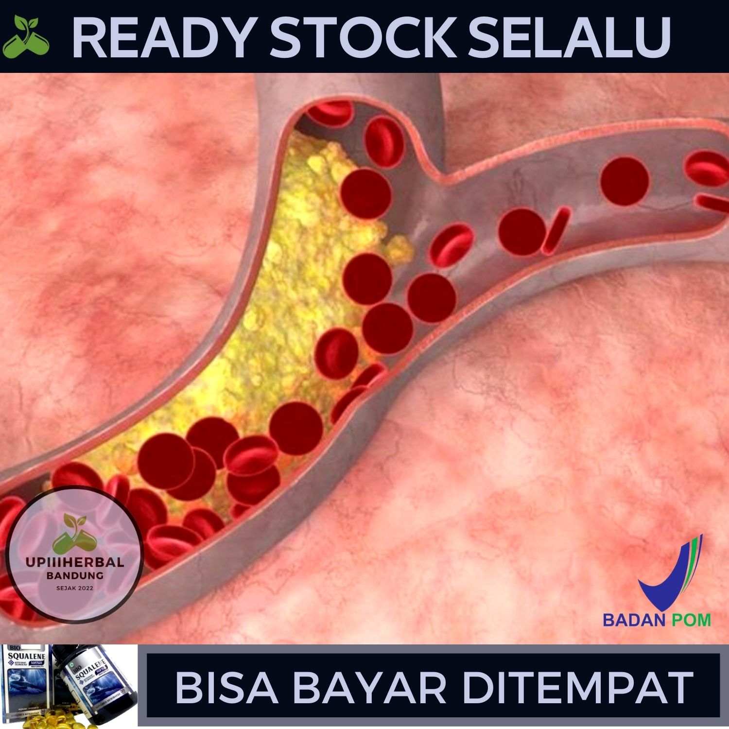 Obat Plak Pembuluh Darah, Obat Untuk Plak Pembuluh Darah, Obat ...