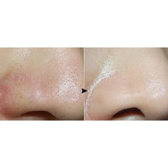 [ 5ML ] Tinh chất se khít lỗ chân lông