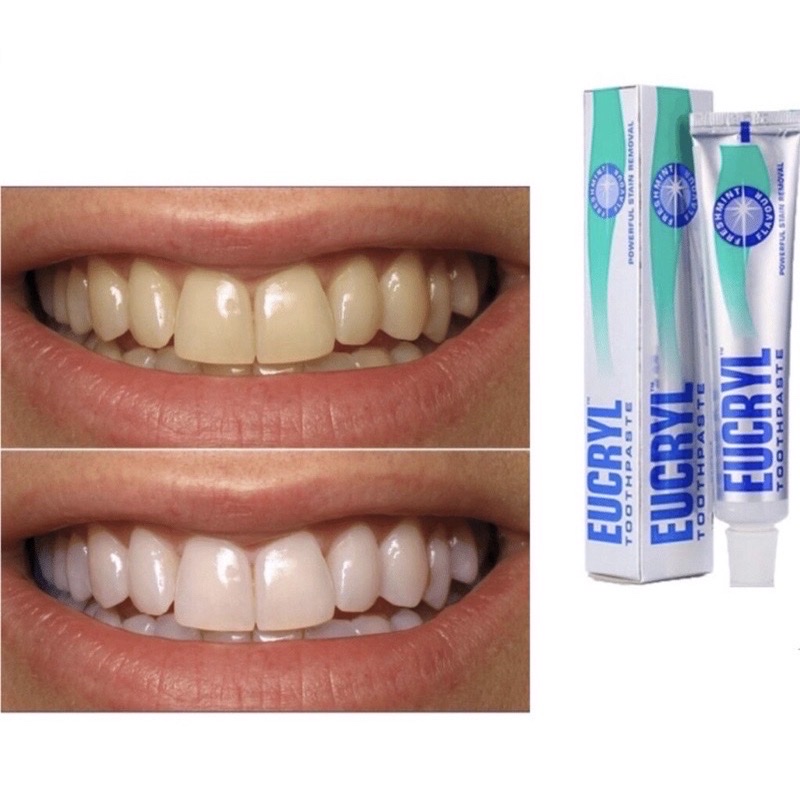 [HCM][Chính hãng] Kem đánh răng Eucryl Toothpaste 62g