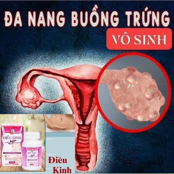 Điều kinh Hằng Thu