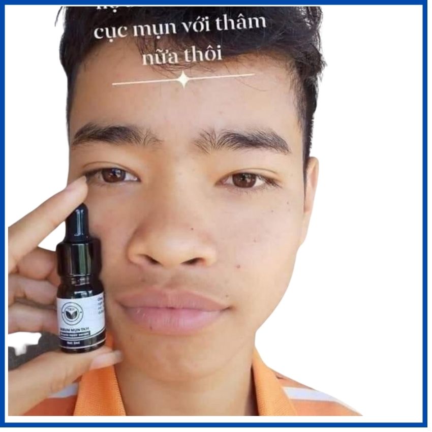 Serum Mụn Trần Kim Huyền