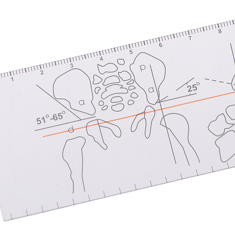 Long Jointing Ruler Multi-Ruler Goniometer Angle Ruler Joint Orthopedics Tool Instruments ...