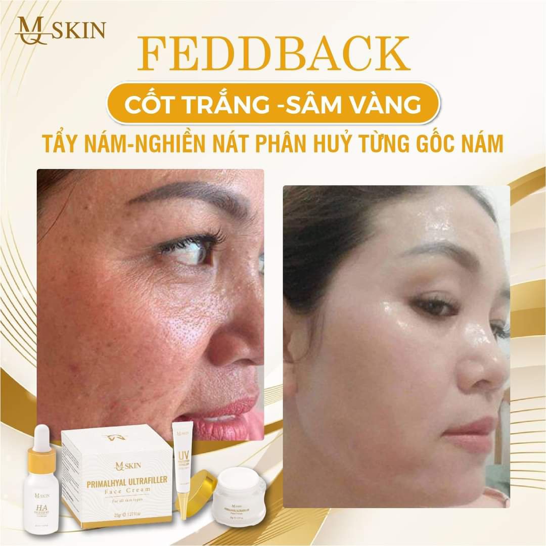 [Ảnh thật] Combo 4 món sâm vàng Mq skin chính hãng