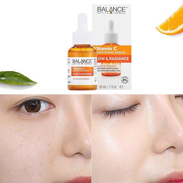 ]Serum Trắng Da Balance Active Formula Vitamin C Brightening 30ml
