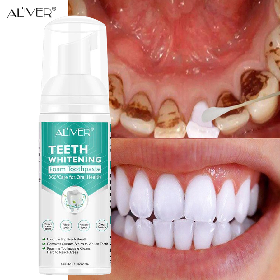 Original ALIVER Teeth Whitening Mousse Toothpaste 60ML Teeth Whitening Yellowing of Teeth Foam