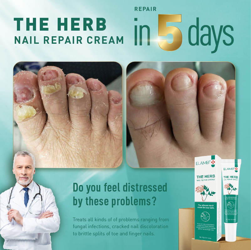 3pcs Nail Fungus Removal Cream Onychomycosis Fungal Nail Treatment  Paronychia Anti Infection Feet Toe Fungal Nail Care Ointment - AliExpress