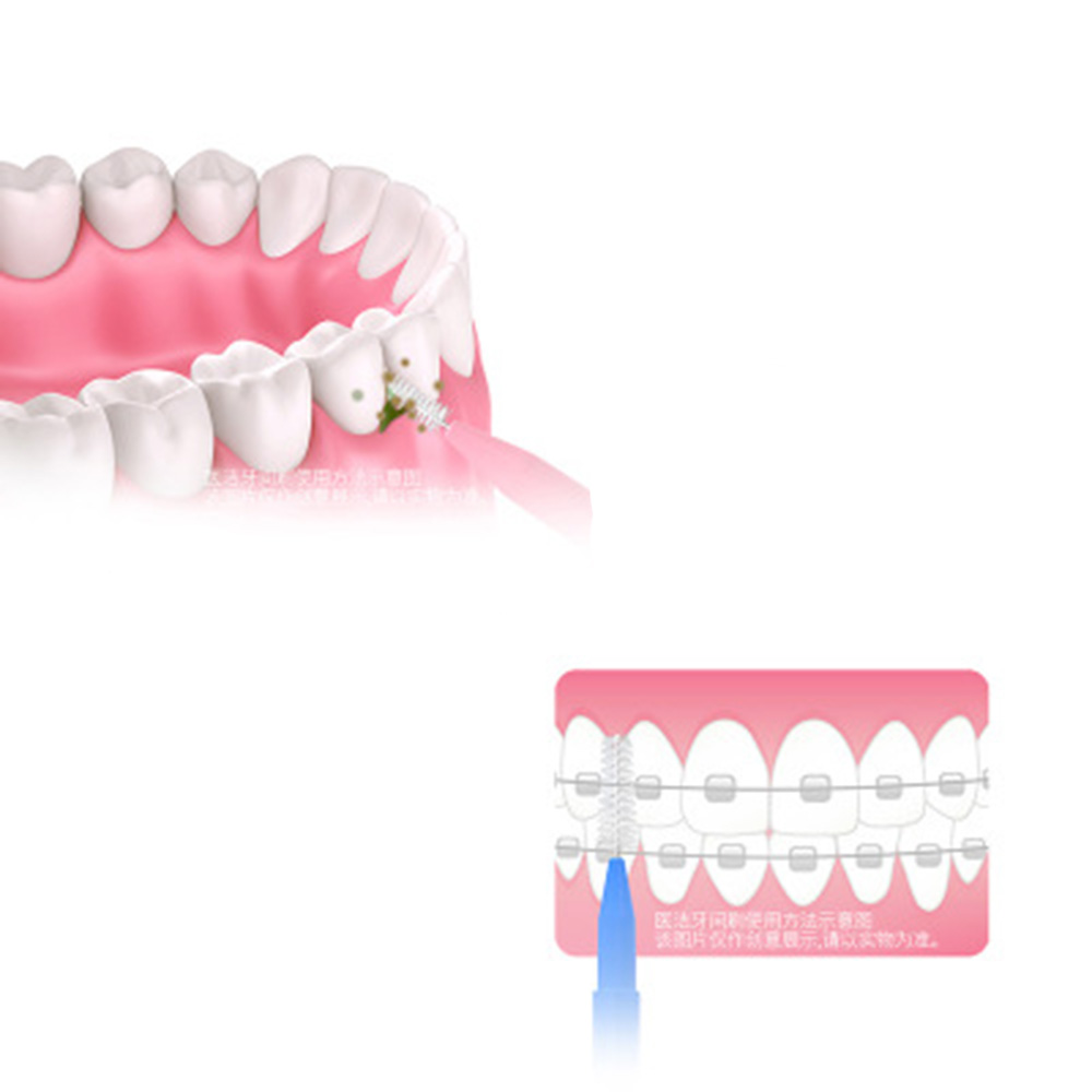 %E3%80%90StoryFusion%E3%80%91I%20Shaped%20Interdental%20Brush%20Denta%20Floss%20Cleaners%20Orthodontic%20Dental%20Teeth%20Brush%20Toothpick%20Oral%20Care%20-%20Image%203
