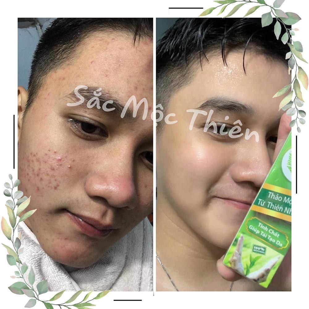 Sắc Mộc Thiên Combo Tái Tạo Da Cao Cấp
