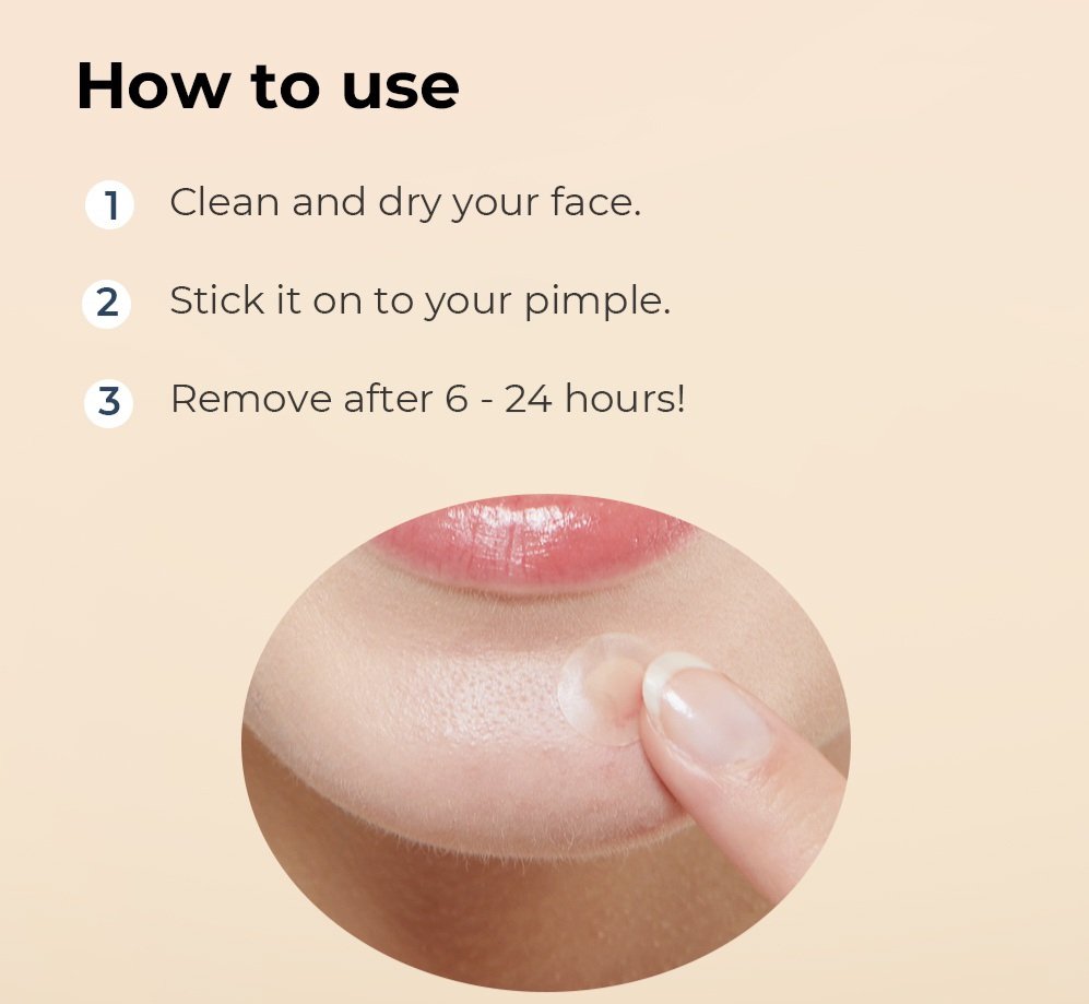 Miếng dán mụn Cosrx Master Patch Hydrocolloid (36 Patches) - Basic