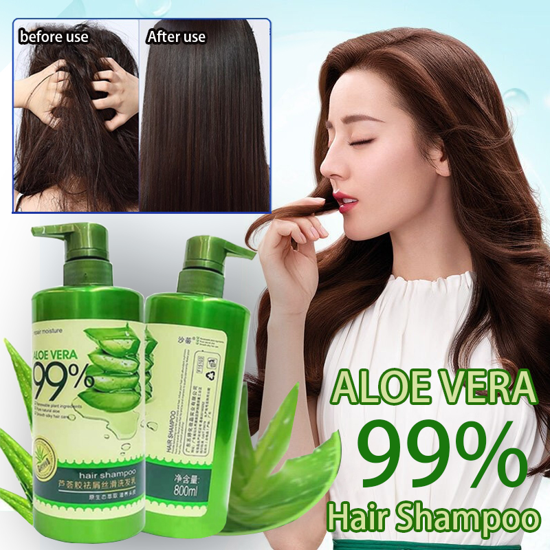 aloe vera shampoo and conditioner Original 100% Aloe Vera Anti-Dandruff  Shampoo 800ml and Aloe Vera Nourishing Conditioner 800ml to Help Hair  Growth and Prevent Hair Loss (FDA Approved) conditioner for hair aloe