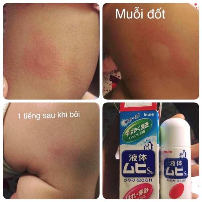 Lăn trị muỗi đốt, côn trùng cắn Muhi Nhật Bản 50ml