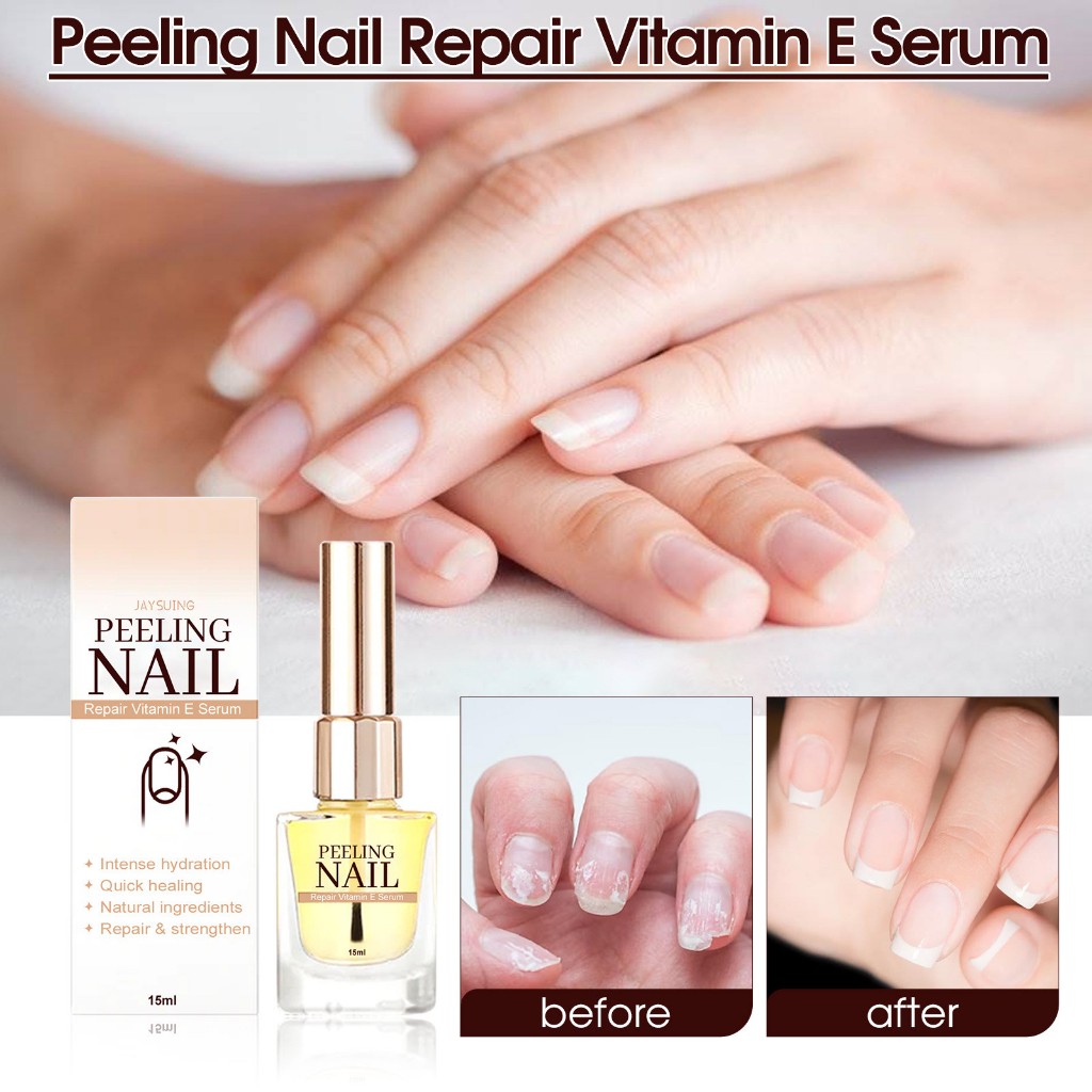 Dưỡng móng Peeling Nail hồi phục móng hư tổn
