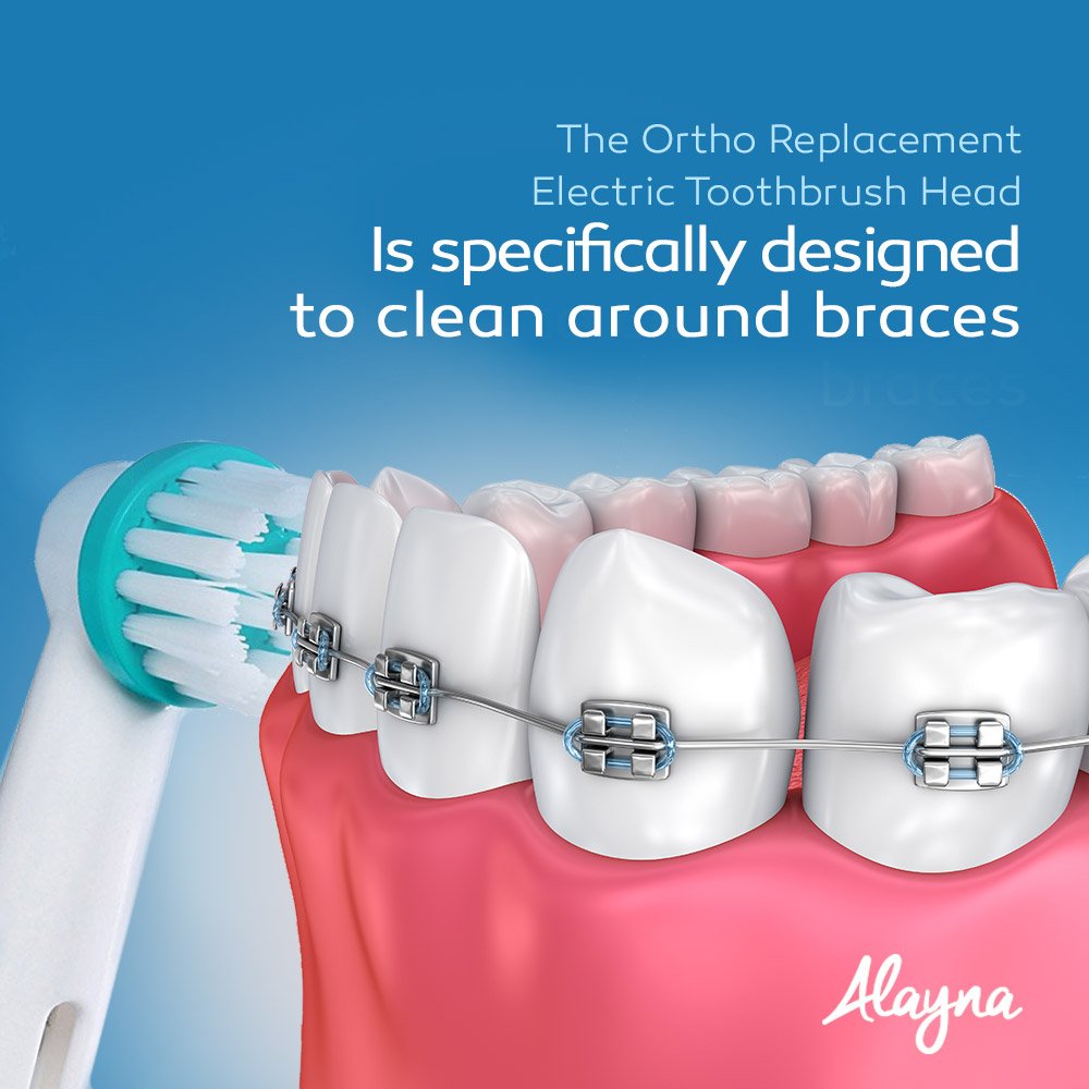 %E3%80%90EleganceWorld%E3%80%91Oral%20B%20Interproximal%20Clean%20Replacement%20Brush%20Heads%20For%20Oral-B%20Professional%20Ortho%20Orthodontic%20Electric%20Toothbrush%20Heads%20-%20Image%203