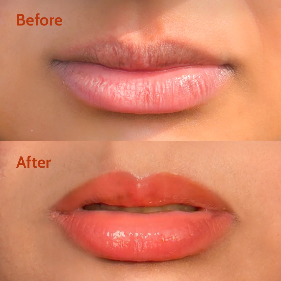 Chemist%20At%20Play%20Peach%20Tinted%20Lip%20Balm%20for%20Dark,%20Dry,%20Chapped%20and%20Pigmented%20Lips%7C%20Gives%2024%20hours%20moisturization%7C%20SPF%2050%20PA++++%7C%20Has%202%25%20Kojic%20Acid,%20Hyaluronic%20Acid,%20ceramides%20&%20Peptides%7C%2010gms%20-%20Image%204