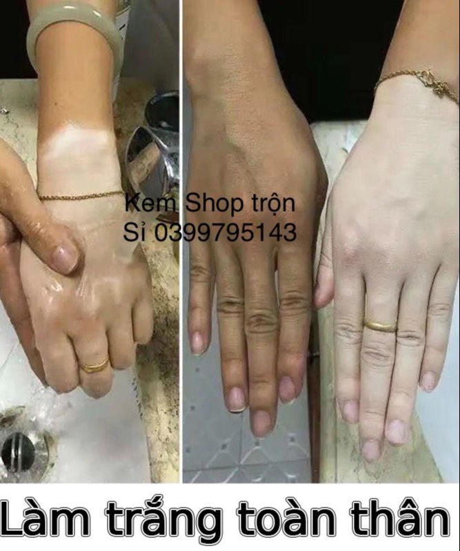 [HCM]Công Thức Kem Trộn Trắng Da Toàn Thân 143k