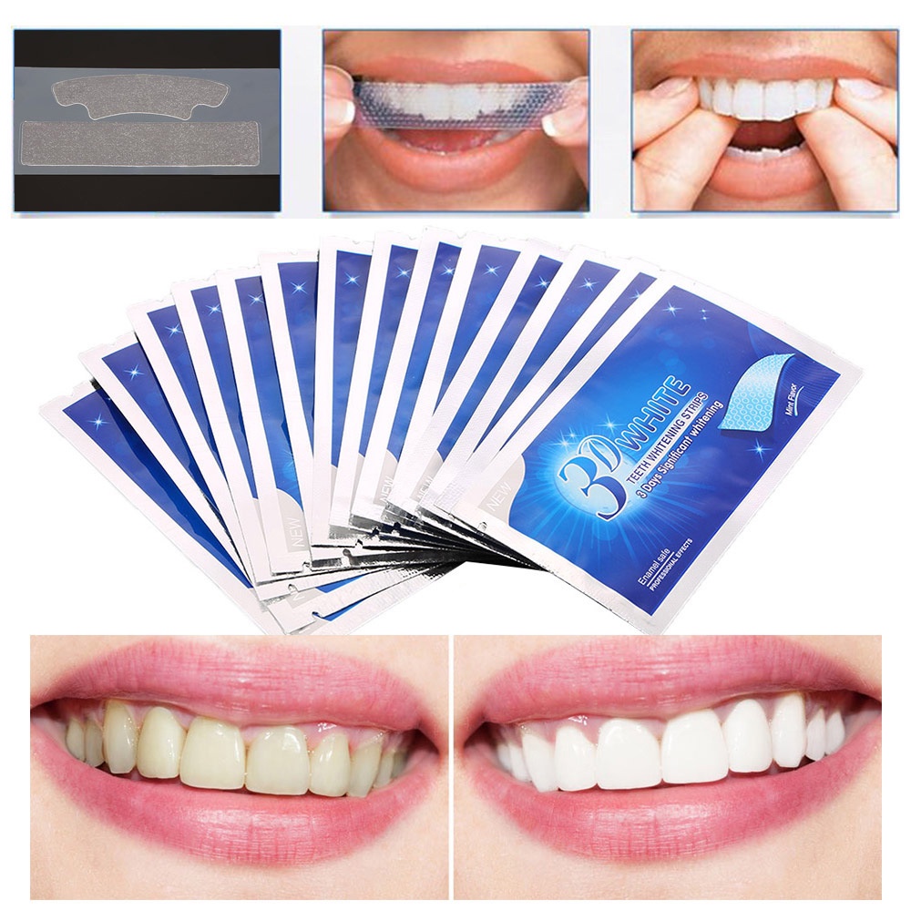 Miếng dán làm trắng răng 3d tiện dụng