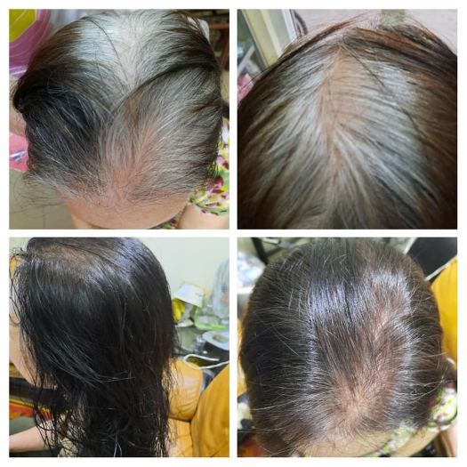 Dầu gội đen tóc Caotien - hộp 10 gói