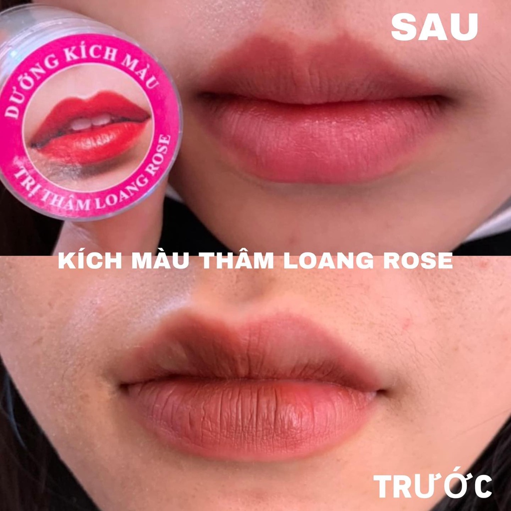 DƯỠNG KÍCH MÀU THÂM LOANG ROSE