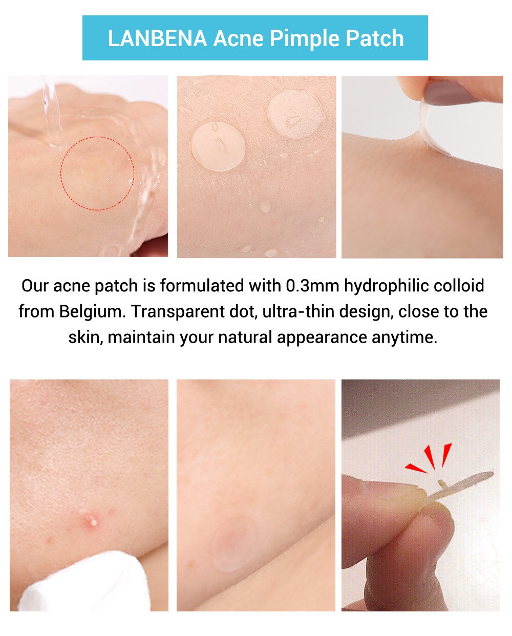 Miếng dán mụn Lanbena Acne Pimple Patch