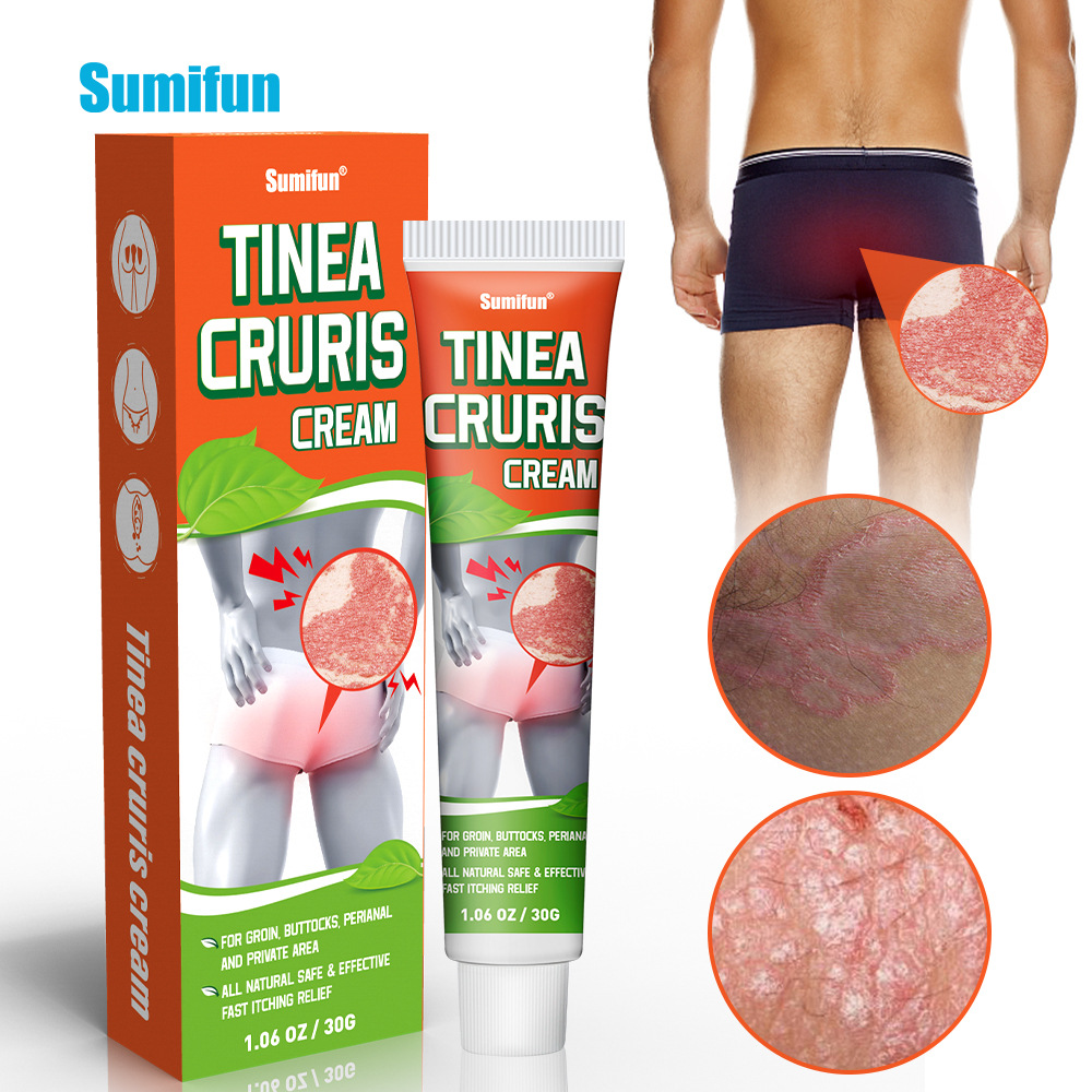 Tinea Cruris Cream 30g Groin Peri Stigmata Pimple Skin Rash