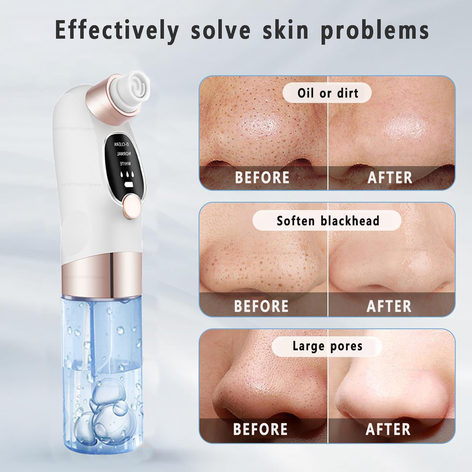 Blackhead Remover Pore Vacuum Face T Zone Cleaner Pimple Black Head Removal Electric Water Cycle Facial Nose Blackhead Removal. 