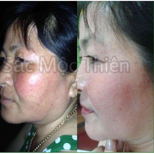 Linh Chi Mộc Sắc Mộc Thiên Rửa Mặt