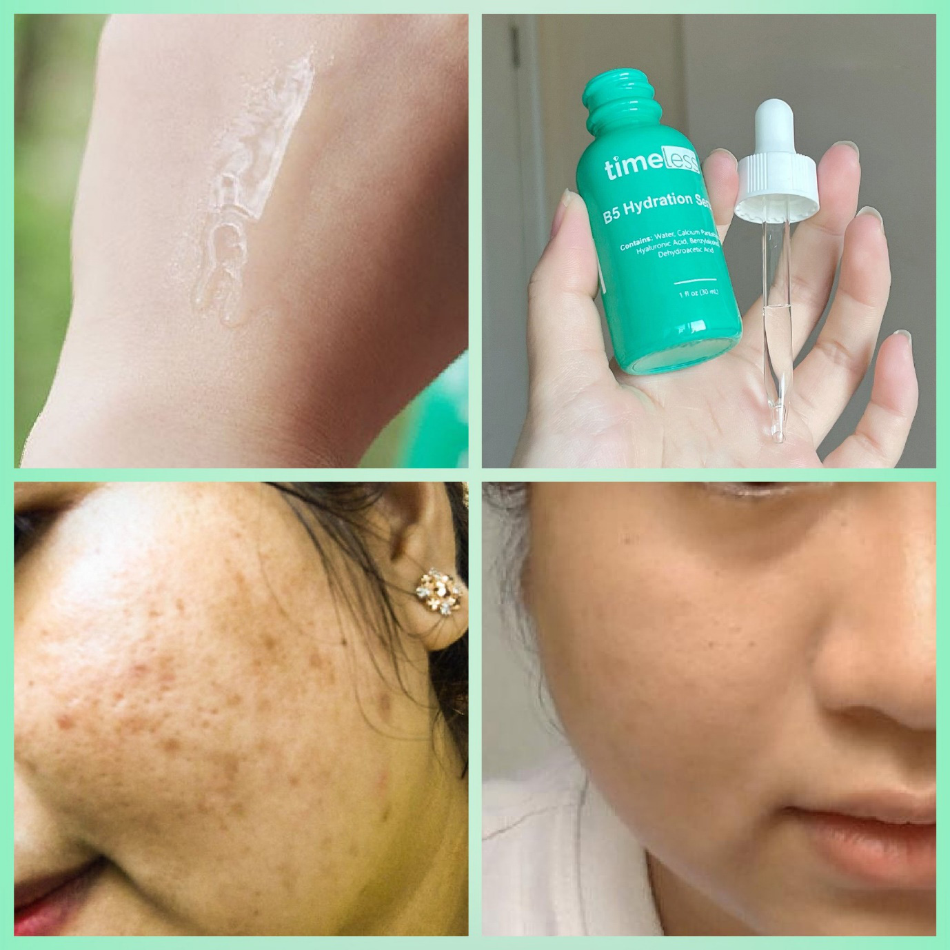 [HCM]Serum tái tạo phục hồi da B5 Timeless 30ml