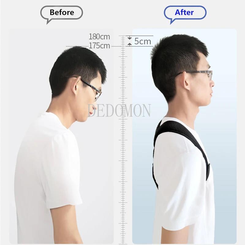 Brace Support Belt Adjustable Back Posture Corrector Clavicle Spine Back Shoulder Lumbar Posture Correction Shoulder Back Blet. 