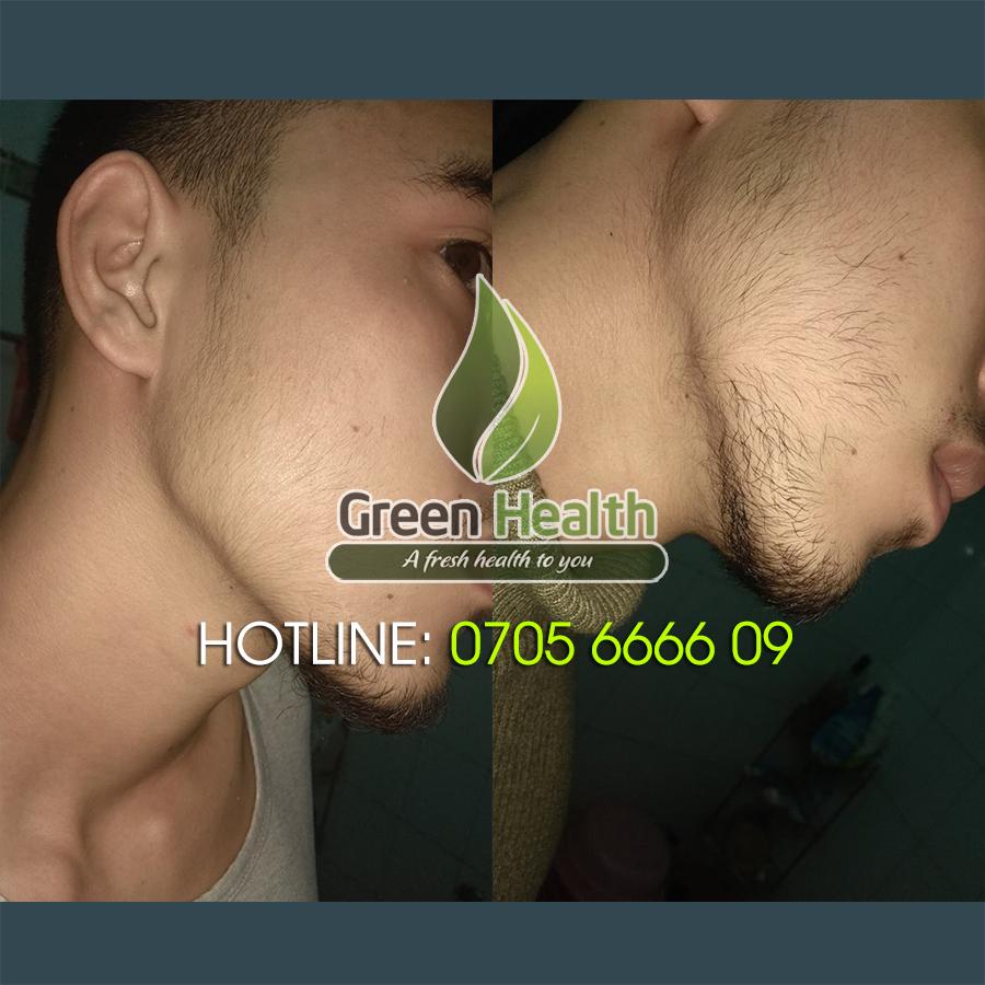 Serum Hỗ Trợ Mọc Râu Quai Nón Minoxidil 12,5% Morr