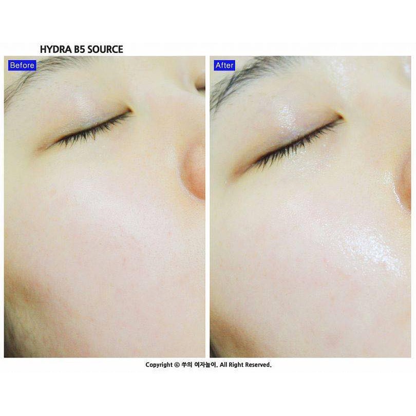 Tinh Chất Ciracle Hydra Dưỡng Da B5 Hàn Quốc 30ml