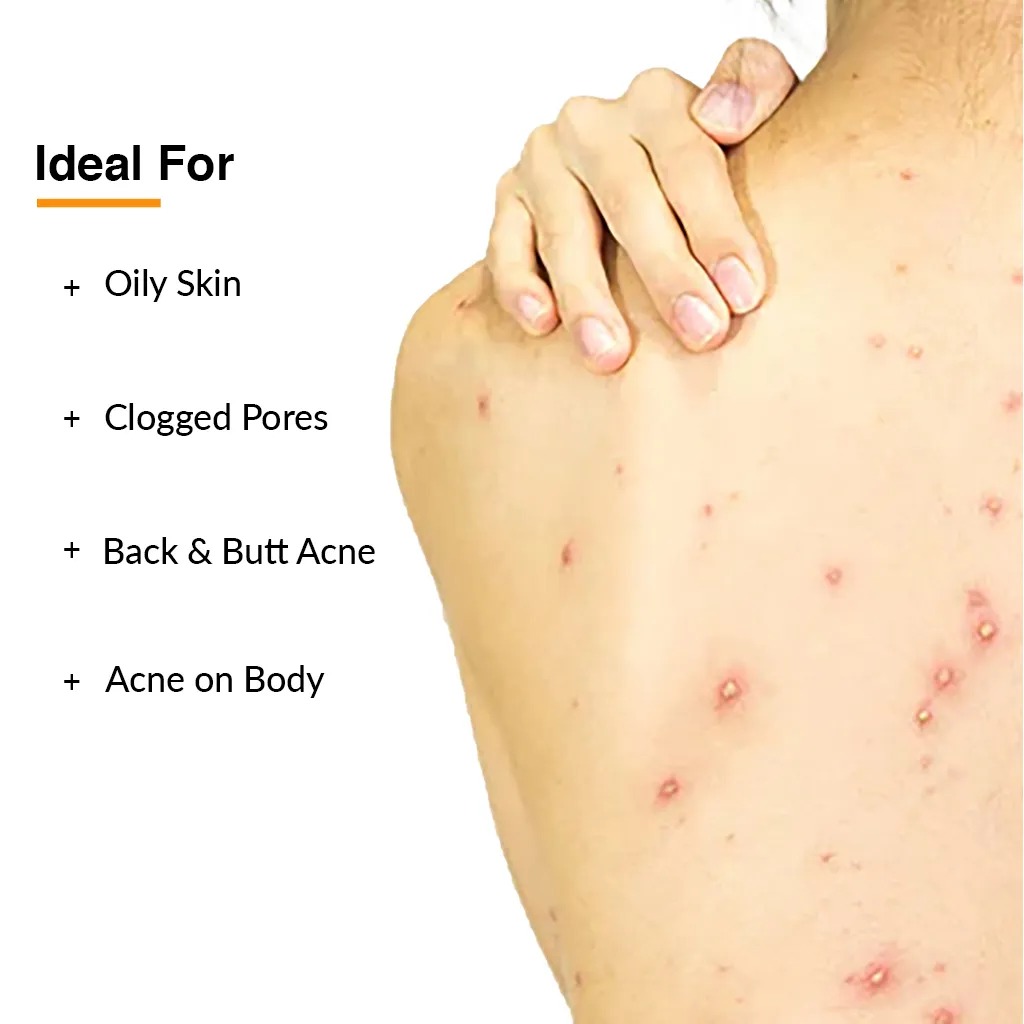 Fix%20Derma%20Salyzap%20Body%20Wash%20For%20Body%20Acne%20200%20ml%20%7C%20Salicylic%20Acid%20%7C%20Tea%20Tree%20Oil%20%7C%20From%20HyperMart%20%7C%20Hyper%20Mart%20%7C%20Election%20%7C%20buy%20during%20election%20commission%20nepal%20-%20Image%208