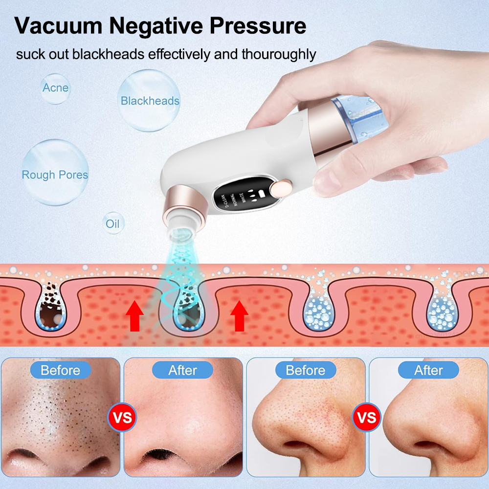Blackhead Remover Pore Vacuum Suction Face Cleaner USB Rechargeable Comedone Acne Black Head Removal Facial Black Dot Extractor. 