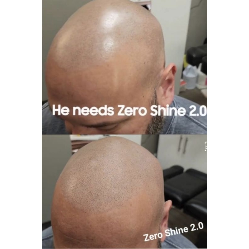 Zero Shine 2.0 by DermMicro - for matte effect after scalp  micropigmentation SMP