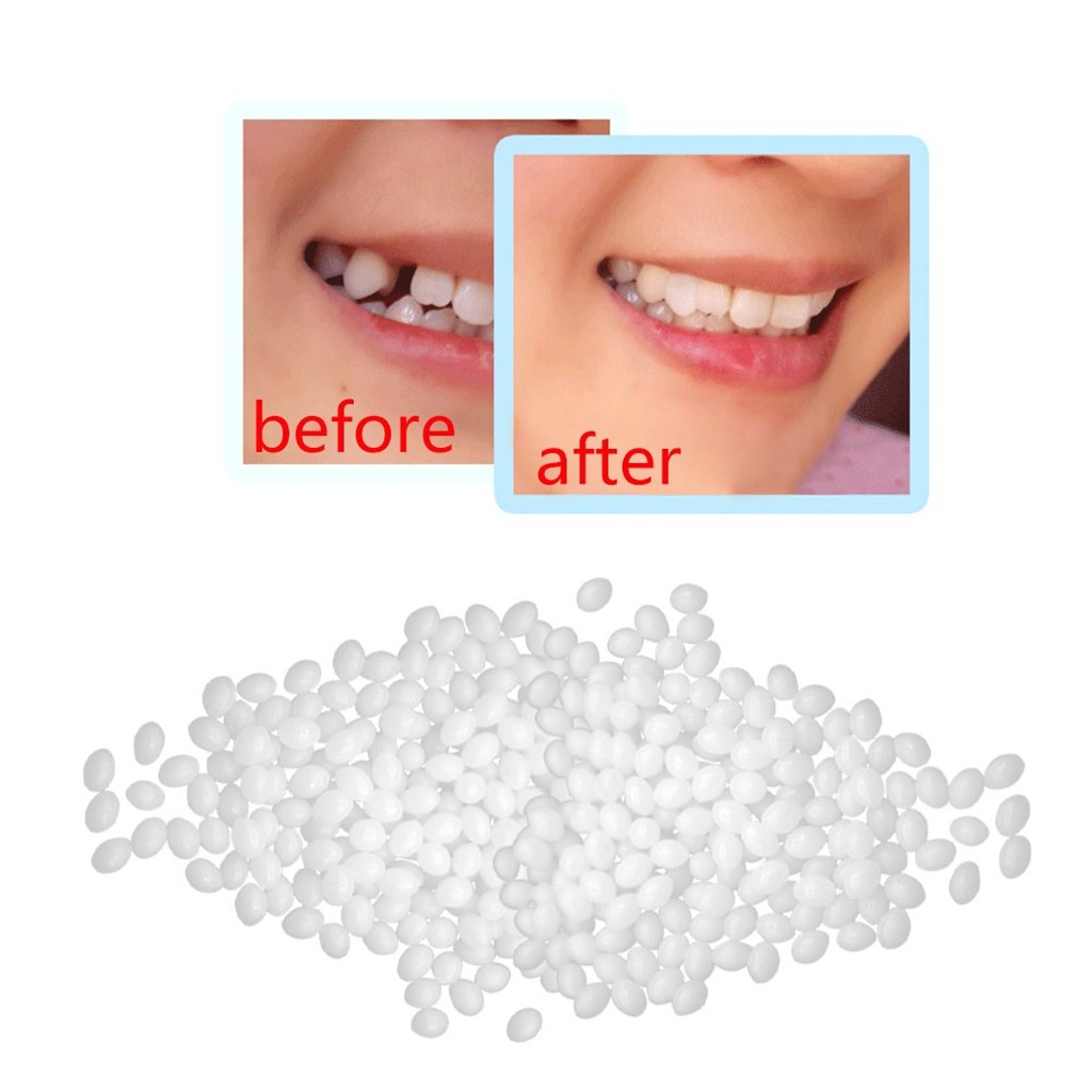 Plastic Teeth Glue Makeup Dentures Modified Temporary Filling Teeth Filling  Teeth Glue Filling Holes Broken Teeth Cavity Filler for Teeth Temporary