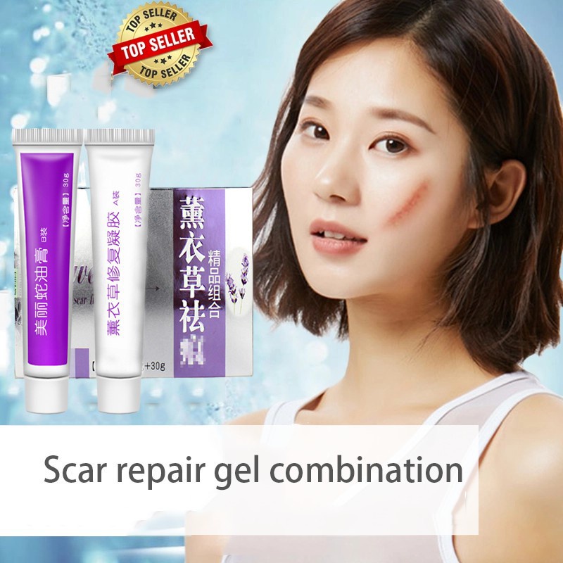 Acne Scar Removal Cream 30gskin Repair 30g Skin Repair Face Cream Acne Spots Acne Treatment 9105