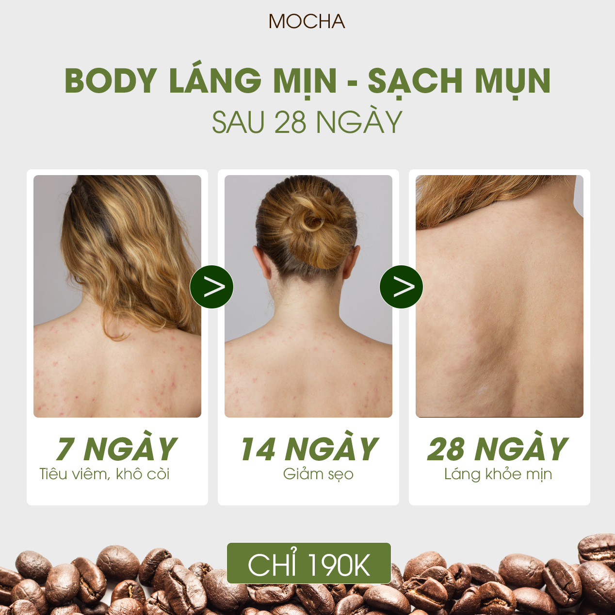 Xà Phòng Giảm Mụn Lưng Mocha Acne Body Soap