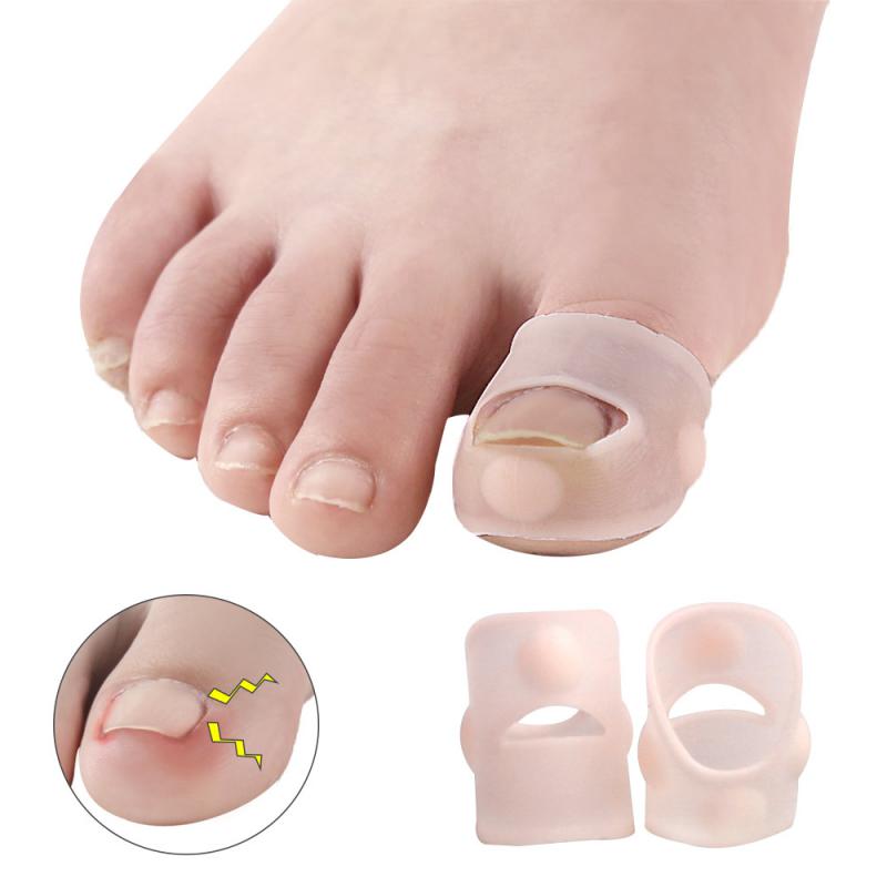 Wenefang%20Fashion%201/3/5PCS%20Ingrown%20Toe%20Nail%20Correction%20Tool%20Toenail%20Straightening%20Tool%20Repair%20Kit%20Patch%20Correctors%20Nail%20Care%20Orthosis%20Foot%20Tool%20-%20Image%205
