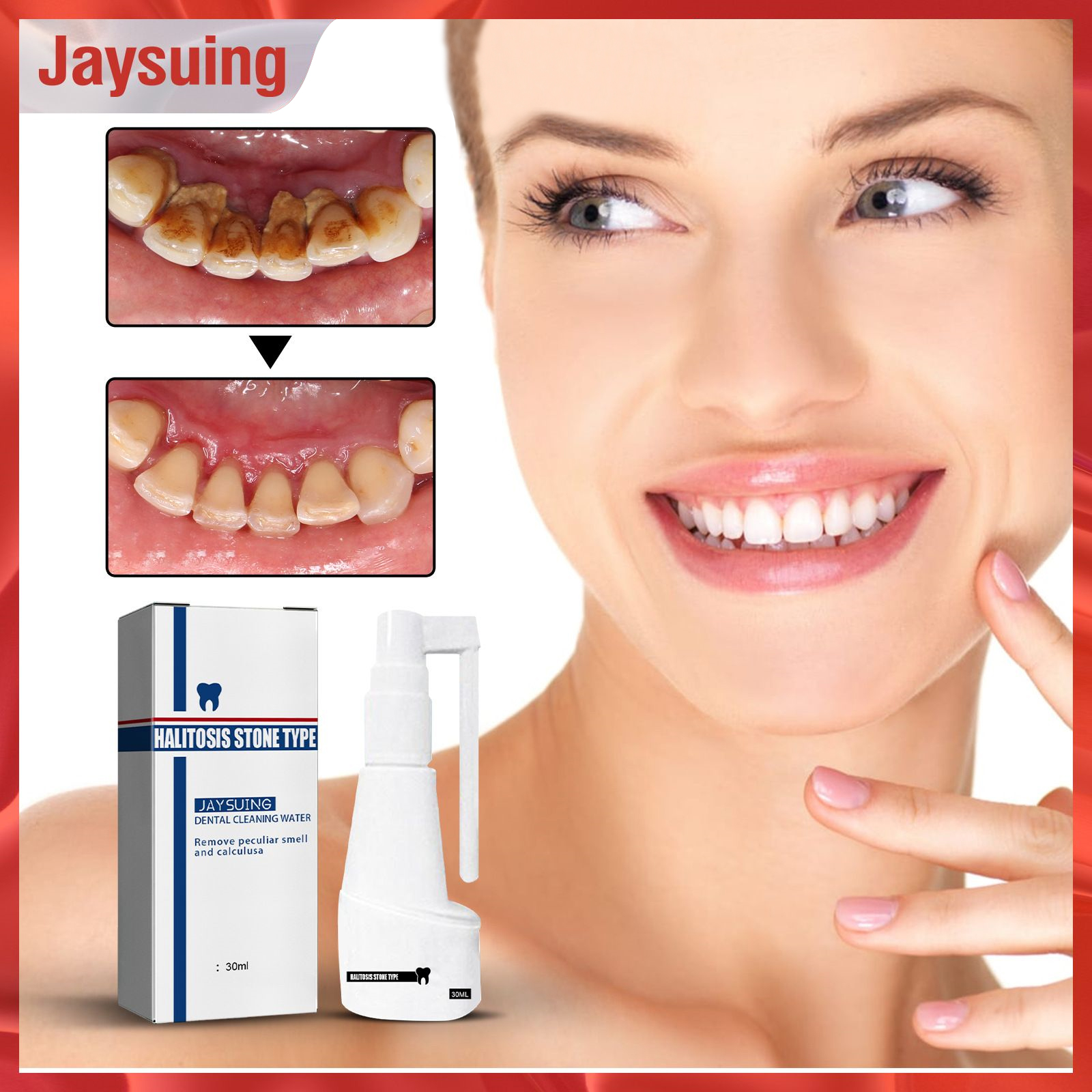 Jaysuing Calculus Dissolving Dental Spray Remove Bad Breath Lasting ...